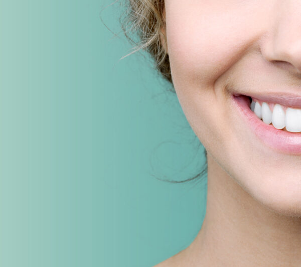 Professional Teeth Whitening in Edmond, OK: Is It Worth It?