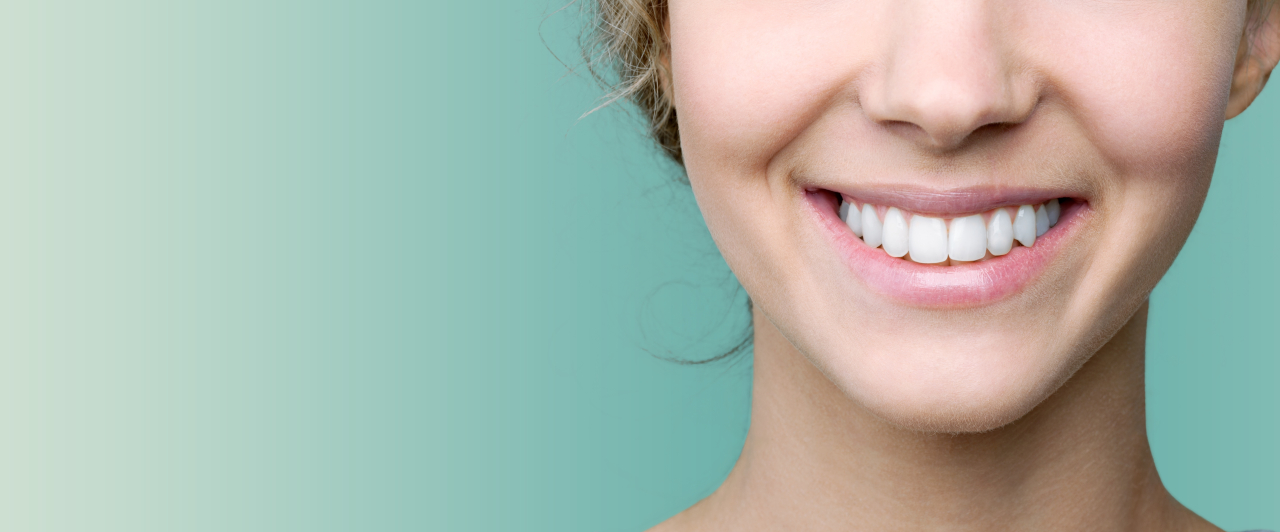 Professional Teeth Whitening in Edmond, OK: Is It Worth It?